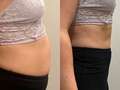 Shoppers are swearing by 'game changing' supplements that massively reduce bloat dqxikeidqkikdinv