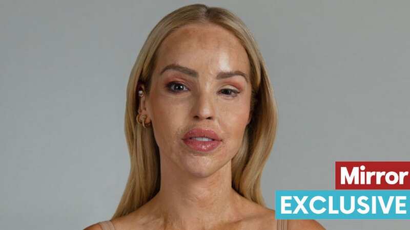 Katie Piper 