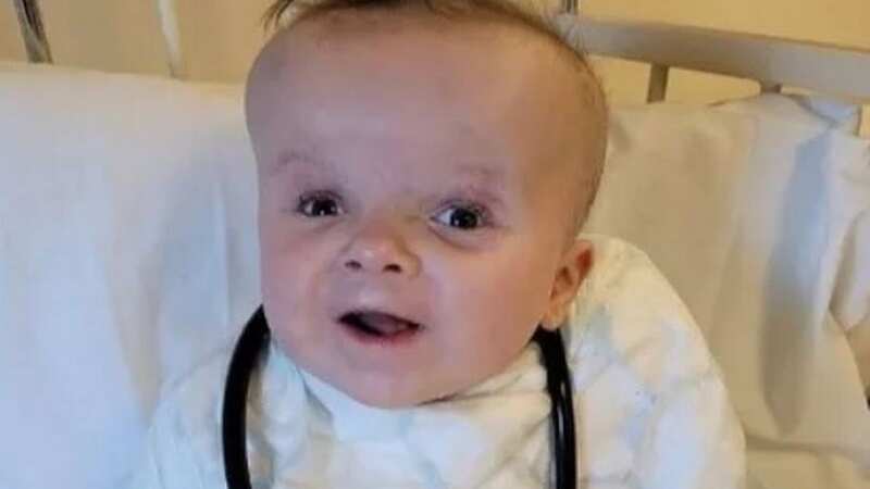 Olivia Volley is one of 20 people known to be suffering from SIFD worldwide (Image: Sally Volley)
