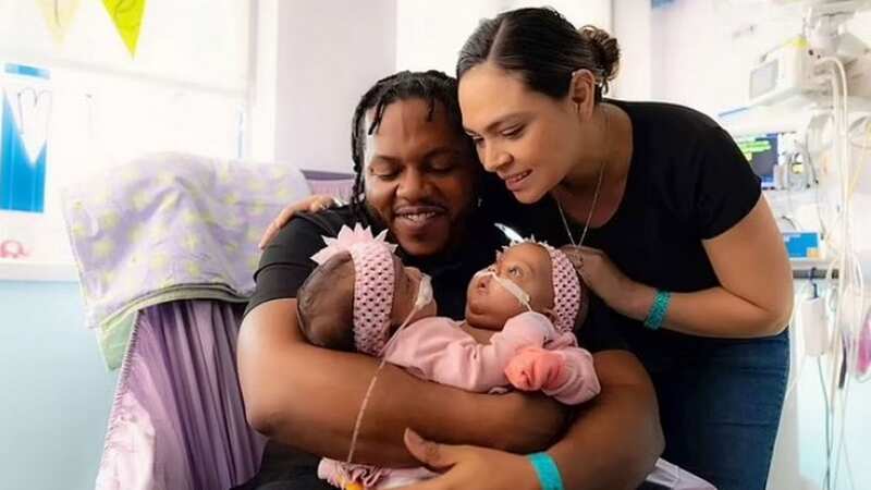 Conjoined twin babies AmieLynn and JamieLynn Finley have been separated following an 11-hour procedure (Image: Facebook)