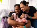 Conjoined twins attached at the stomach separated after 11-hour procedure