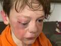 Boy, 12, 'brutally beaten in park by man and teens' is now scared to leave house dqxikeidqkikdinv