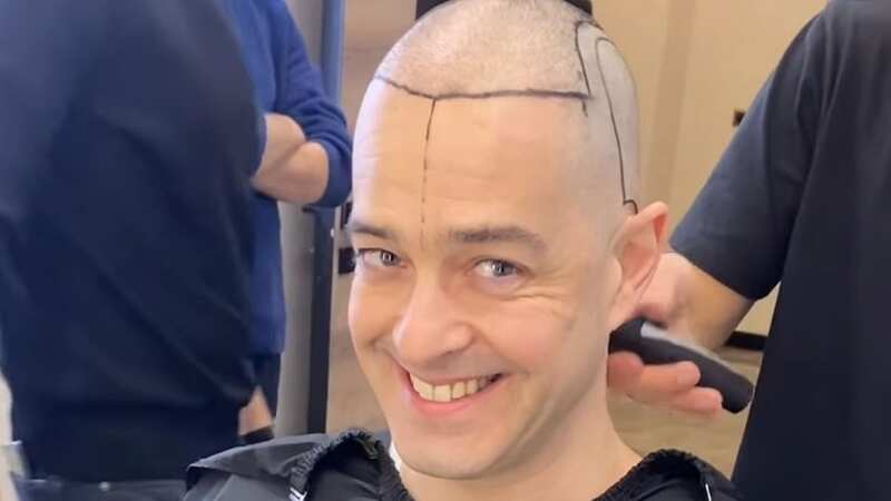 Lee Mead shows off new hair following seven-hour transplant ordeal