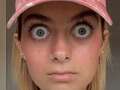 Woman looks just like Lord of the Rings character Gollum due to her huge eyes