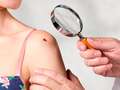 Five common warning signs of cancer in young people from moles to weight changes dqxikeidqkikdinv