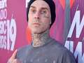 Travis Barker shows gruesome injury as drummer breaks bone 'again' in same place dqxikeidqkikdinv
