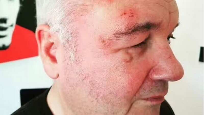 Eamonn Holmes 