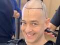 Inside Lee Mead's gruelling 7-hour hair transplant - Turkey procedure to cost dqxikeidqkikdinv