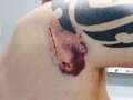 Window cleaner mauled by savage dog says it was like being 'attacked by bear'