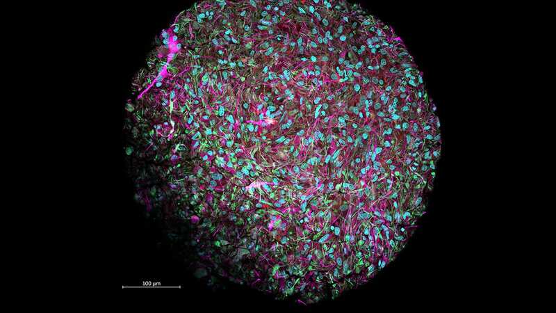 Computers powered by human brain cells to be made using 