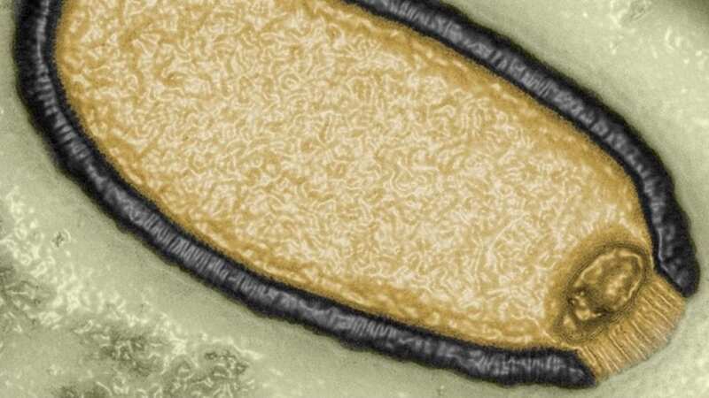 Scientists have revived a ‘zombie’ virus that spent 48,500 years frozen in permafrost (Image: Jean-Michel Claverie/IGS/CNRS-AM)