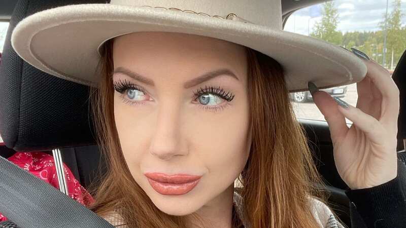 Henna Havila was a Finnish model before she decided to have a nose job to 