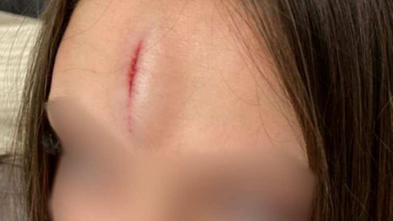 A mum was furious when a door hit her daughter 