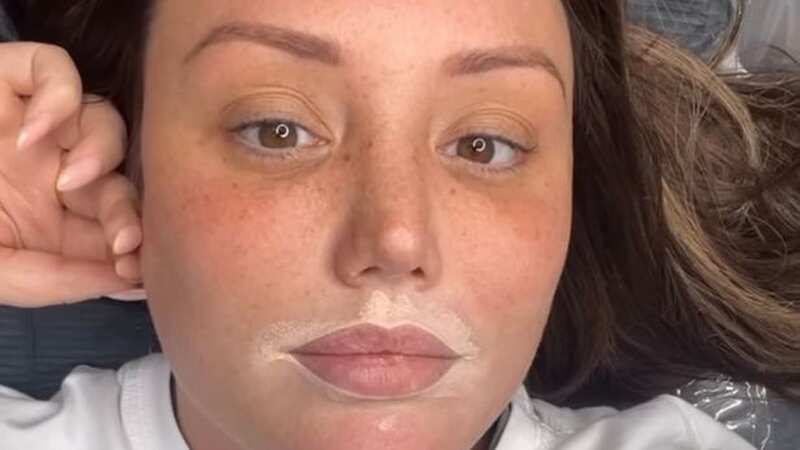 Charlotte Crosby thrilled with permanent make-up after getting fillers dissolved