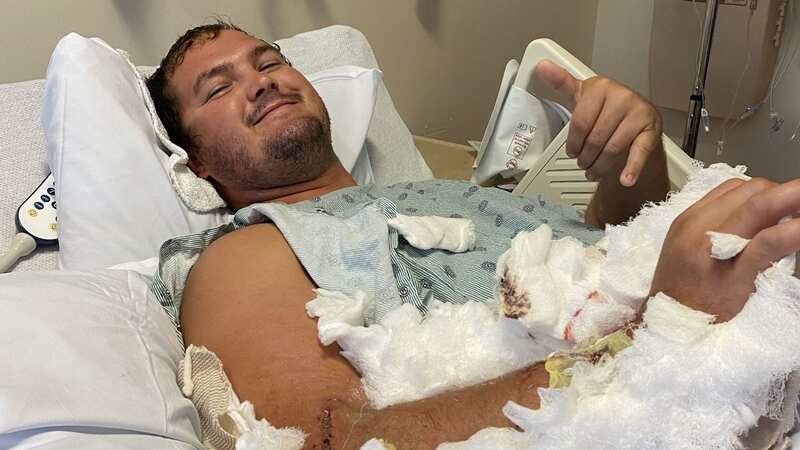 He spent 10 days in hospital recovering from his injuries (Image: Kennedy News and Media)