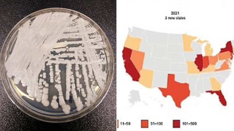 The Candida auris fungus growing in a petri dish (Image: Shawn Lockhart/AP/REX/Shutterstock)