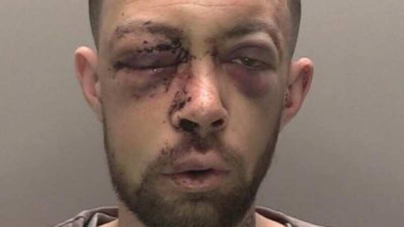 Thomas McComish was left with facial injuries and taken to hospital after attacking two police officers with a knife (Image: Merseyside Police)
