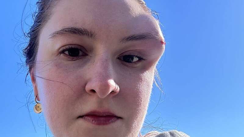 Rachel Pepper injured herself when slipping on black ice (Image: Kennedy News & Media)