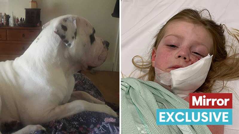 This American Bulldog named Junior mauled little Luna-Ann Forsyth (Image: Amy Hobson)