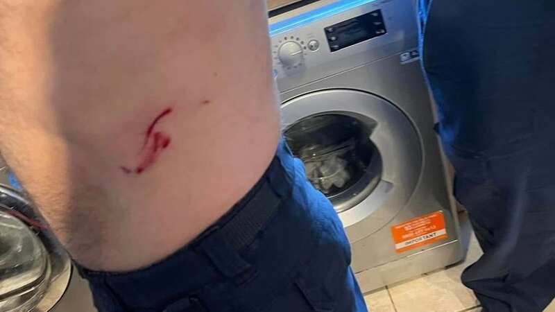 One of the injuries suffered by Simon Edge in the attack (Image: Simon Edge)