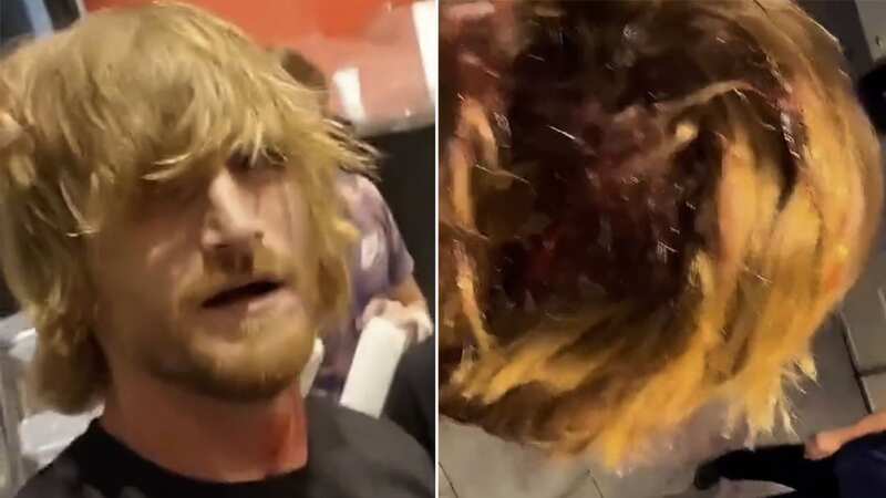 Logan Paul lookalike shows off bloody head injury from Nate Diaz street fight