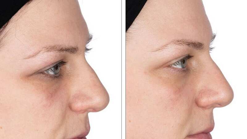 Eye bags were smaller after regular use (Image: Nip+Fab)