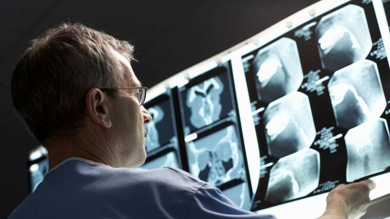 Macmillan Cancer Support says around 600 people in the UK are diagnosed with bone cancer each year. (Image: Getty Images/Image Source)