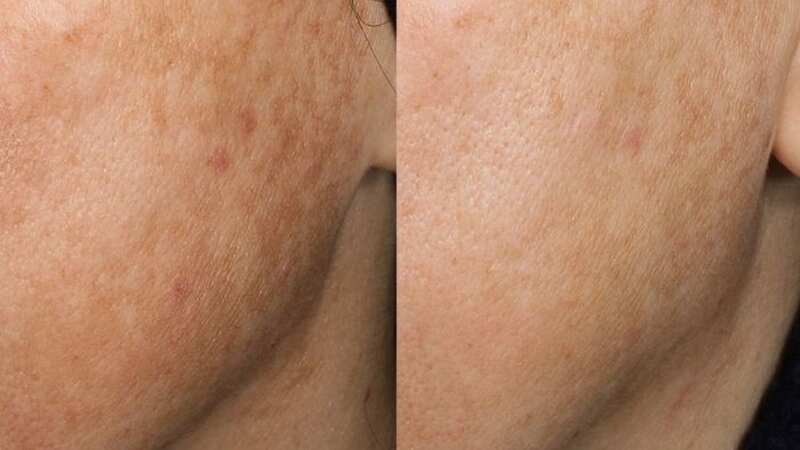 The serum has been proven to show results in just 4 weeks