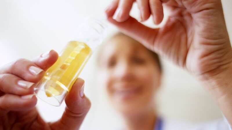 A urine test could be used to detect bladder cancer (Image: Sunday Mirror)