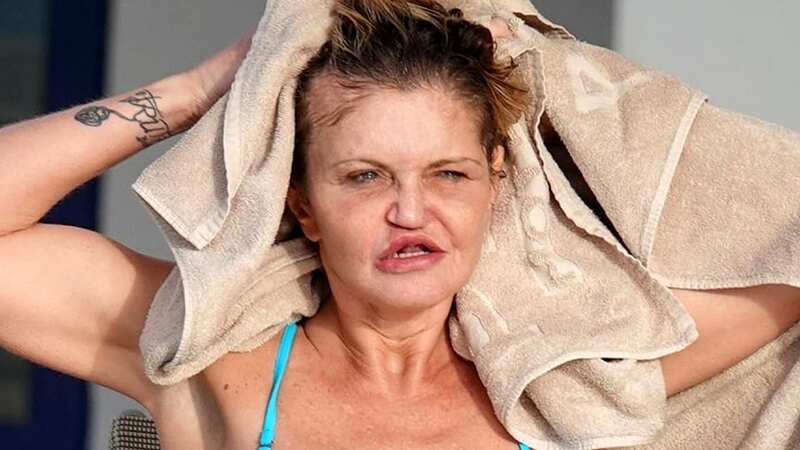 Danniella Westbrook left with gaping hole in head as she regrets surgery abroad