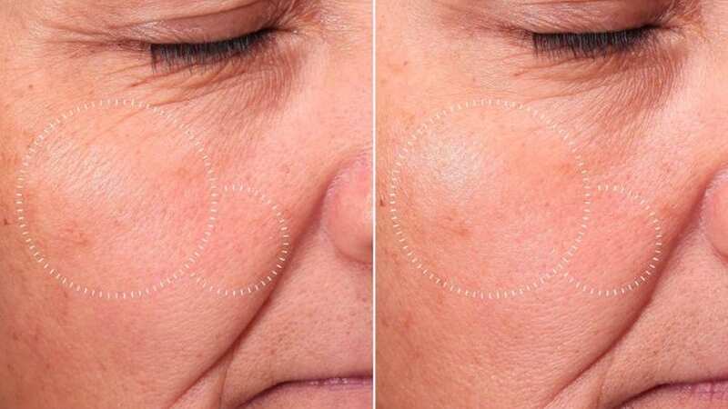 The toner has been clinically proven to work in just 4 weeks!