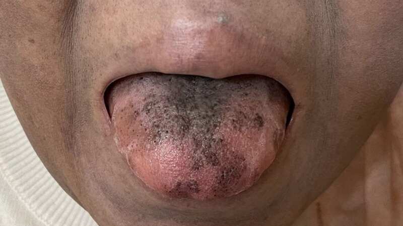 The unnamed woman has suffering cancer (stock image) (Image: Getty Images)