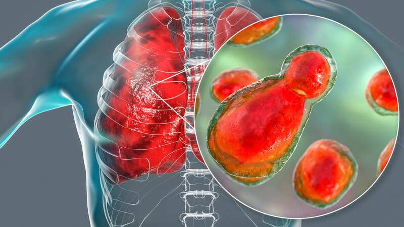 There are thought to be more than 200 Americans at risk of the disease (Image: Getty Images/Science Photo Library RF)