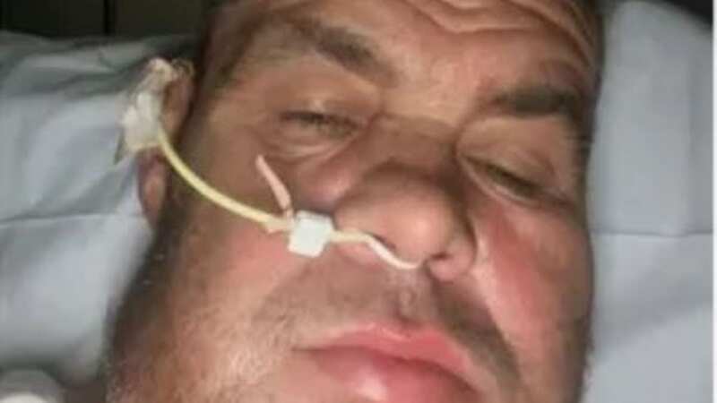 Paul was diagnosed with oral carcinoma (Image: Samantha Hannon)