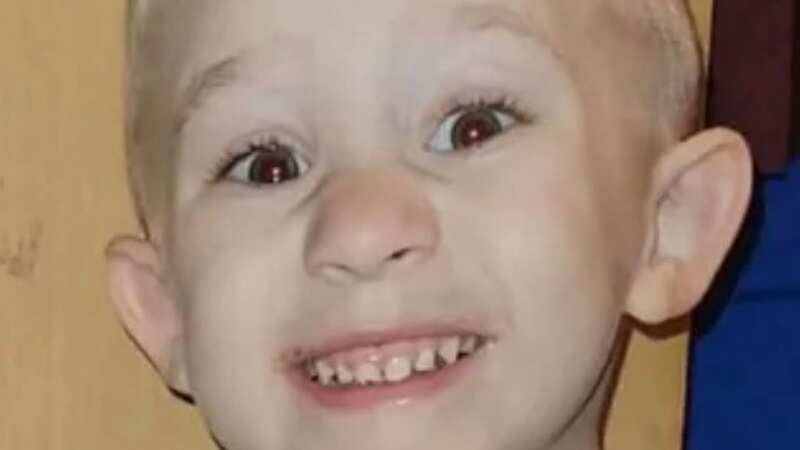 Kameron Swaab was mauled in the face (Image: Gofundme)
