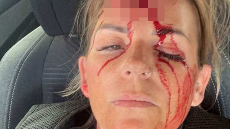 PC Wood was injured during an arrest in Wakefield on Friday (Image: West Yorkshire Police)