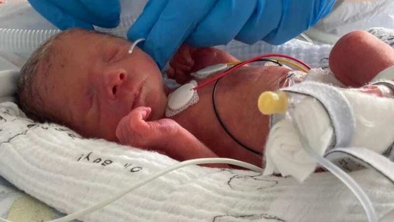 Baby Rupert in hospital where he was smaller than his teddy bear (Image: Penelope Taylor-Jones / SWNS)