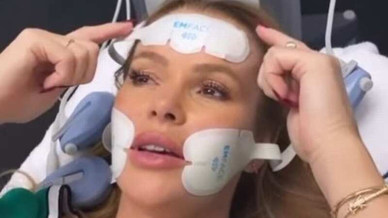 Amanda Holden shows off facelift as she says she