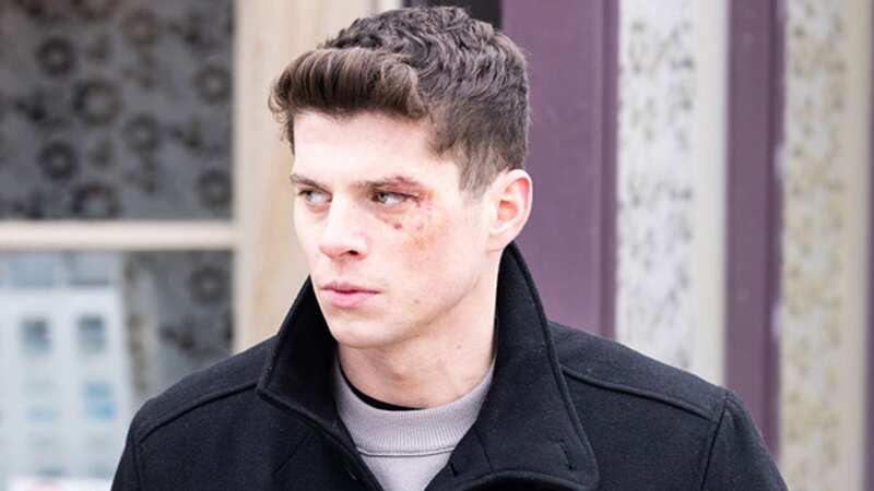 Lewis Cope has teased that Nicky Miligan could show a darker side on Emmerdale in the coming weeks after it was revealed he pushed his dad Caleb in a shocking twist