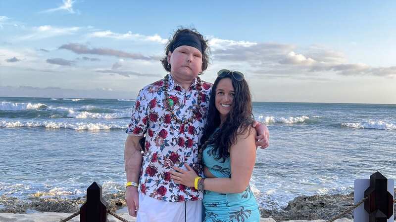 Joe with girlfriend Jessica after his face transplant (Image: Joe DiMeo / SWNS)
