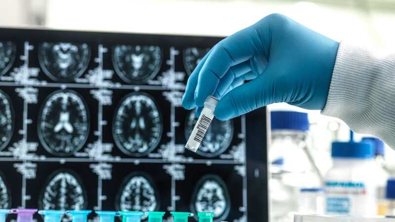 Clinical trials for drugs could slow the progress of the disease (Image: Getty Images/Science Photo Library RF)