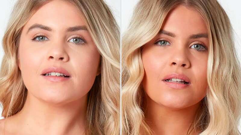 The before and after results are amazing!