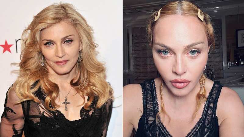 Madonna needs to accept plastic surgery won