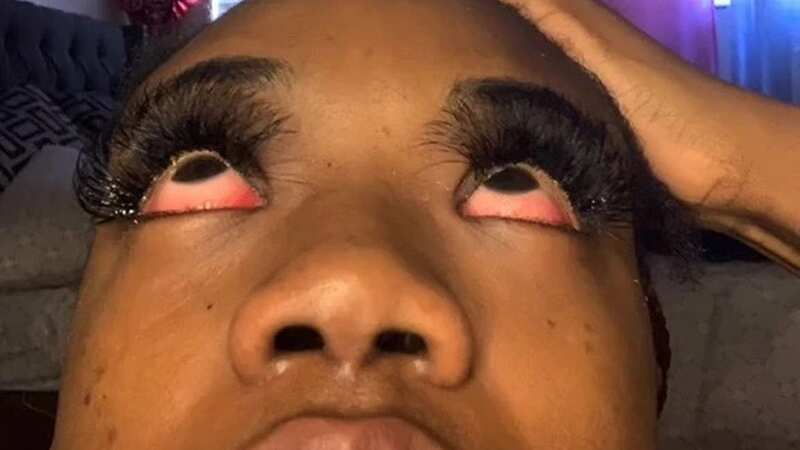 A woman thought she was going blind after she had a very bad reaction to eyelash extensions (Image: keepinupwitkeeks / TikTok)