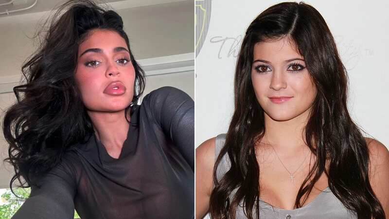Kylie Jenner addresses plastic surgery speculation as she admits it