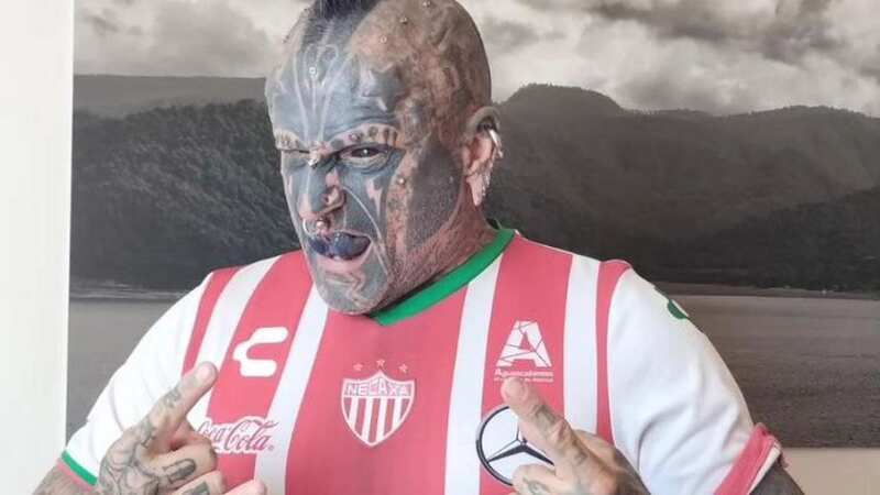 Body modification addict dubbed a 
