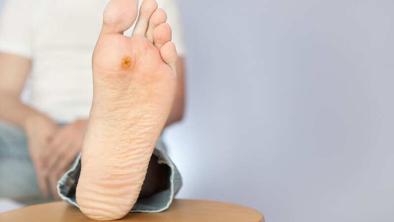 Ulcers on the feet could be a sign of a number of serious diseases (Image: Getty Images/iStockphoto)