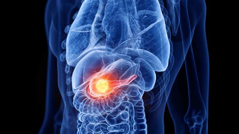 A common sweet could help fight pancreatic cancer, scientists say (Image: Getty Images/Science Photo Library RF)