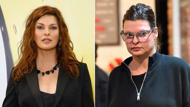 Linda Evangelista, 58, says she still gets Botox despite being left 