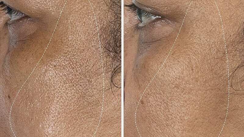 Pores look smaller (Image: Augustinus Bader)